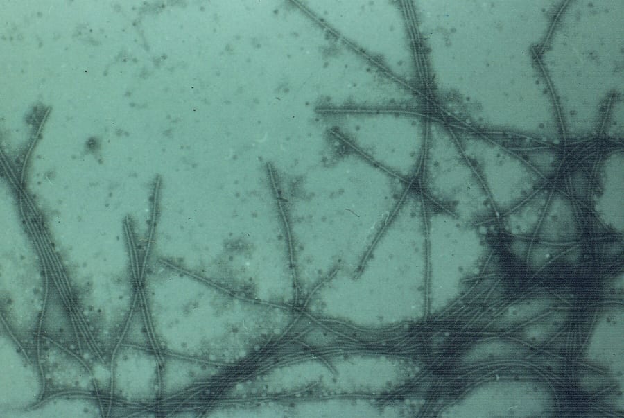 Micrograph of virus particles.